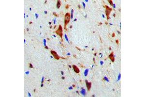 Immunohistochemical analysis of SMG7 staining in human brain formalin fixed paraffin embedded tissue section. (SMG7 antibody  (Center))
