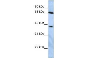 Western Blotting (WB) image for anti-Ubiquitin Specific Peptidase 3 (USP3) antibody (ABIN2458037) (USP3 antibody)