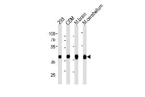 ALDOC Antibody (C-term) ABIN1882208 western blot analysis in 293,CEM cell line and mouse brain,cerebellum tissue lysates (35 μg/lane). (ALDOC antibody)