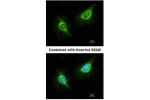 ICC/IF Image Immunofluorescence analysis of methanol-fixed HeLa, using Laminin beta 3, antibody at 1:200 dilution. (Laminin beta 3 antibody)