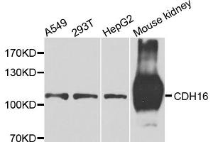 Western blot analysis of extracts of various cell lines, using CDH16 antibody.