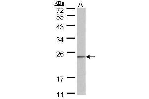 WB Image Sample (30 ug of whole cell lysate) A: 293T 12% SDS PAGE antibody diluted at 1:1000 (NDUFAF4 antibody  (full length))