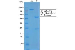 SDS-PAGE analysis of purified, BSA-free recombinant vWF antibody (clone VWF/1859R) as confirmation of integrity and purity. (Recombinant VWF antibody  (AA 1815-1939))