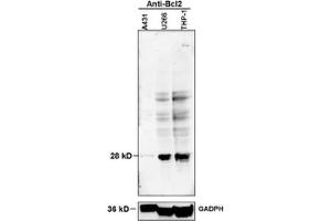 Image submitted by OWL Validation Program. (Bcl-2 antibody  (pSer70))