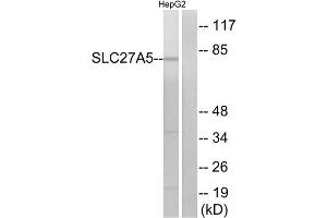 Western Blotting (WB) image for anti-Solute Carrier Family 27 (Fatty Acid Transporter), Member 5 (SLC27A5) (Internal Region) antibody (ABIN1850922) (SLC27A5 antibody  (Internal Region))
