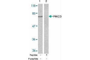 Western blot analysis of extract from MCF-7 cells using PRKCD polyclonal antibody  .