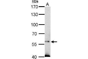 Western Blotting (WB) image for anti-Suppressor of Cytokine Signaling 5 (SOCS5) (N-Term) antibody (ABIN2855921)
