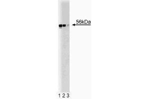 Western blot analysis of Lyn on HEL (human erythroleukemia cell line) lysate. (LYN antibody  (AA 1-138))