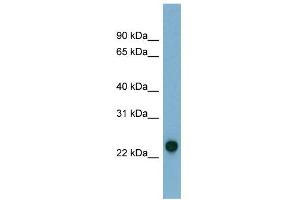 WB Suggested Anti-AK3 Antibody Titration: 0. (Adenylate Kinase 3 antibody  (N-Term))