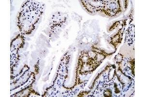 IHC analysis of HNRNPD using anti-HNRNPD antibody (ABIN7602590).