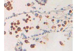 DAB staining on IHC-P; Samples: Human Lung Tissue (PLA1A antibody  (AA 309-452))