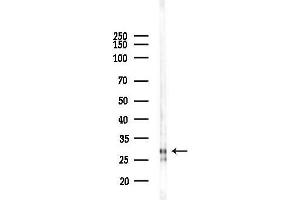 anti-Proteasome (Prosome, Macropain) Activator Subunit 1 (PA28 Alpha) (PSME1) (C-Term) antibody