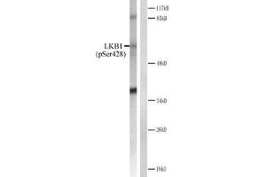 Western blot analysis of extracts from CV-1 cells treated with forsklin. (LKB1 antibody  (pSer428))
