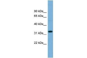 Human OVCAR-3; WB Suggested Anti-OR6C68 Antibody Titration: 0.