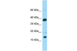 Host: Rabbit Target Name: CALML6 Sample Type: Placenta lysates Antibody Dilution: 1. (CALML6 antibody  (C-Term))