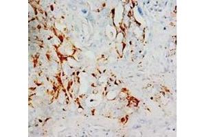 Immunohistochemistry (Paraffin-embedded Sections) (IHC (p)) image for anti-Hypoxia Inducible Factor 1, alpha Subunit (Basic Helix-Loop-Helix Transcription Factor) (HIF1A) (N-Term) antibody (ABIN1107529)