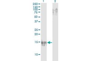 Western Blot analysis of APOB expression in transfected 293T cell line by APOB monoclonal antibody (M14), clone 3E5.