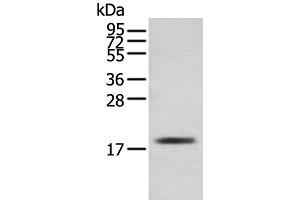 Western blot analysis of Mouse skeletal muscle tissue using TNNC1 Polyclonal Antibody at dilution of 1:250 (TNNC1 antibody)