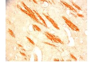 Mouse brain tissue was stained by Rabbit Anti-Metasin (1-25) / KISS-1 (68-92) (Human) Serum (KISS1 antibody  (AA 1-25, AA 68-92))
