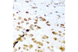 Immunohistochemistry of paraffin-embedded mouse brain using ELAVL3 antibody at dilution of 1:200 (40x lens).