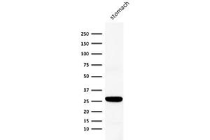 Western Blot Analysis of human stomach lysate using Connexin 32 Mouse Monoclonal Antibody (Clone M12. (GJB1 antibody)