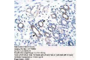 Human kidney (YBX2 antibody  (Middle Region))