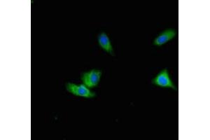Immunofluorescent analysis of Hela cells using ABIN7150586 at dilution of 1:100 and Alexa Fluor 488-congugated AffiniPure Goat Anti-Rabbit IgG(H+L) (ALG12 antibody  (AA 367-422))