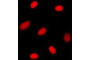 Immunofluorescent analysis of MGMT staining in T98G cells. (MGMT antibody  (N-Term))