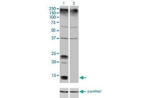 Western blot analysis of KCNE1 over-expressed 293 cell line, cotransfected with KCNE1 Validated Chimera RNAi (Lane 2) or non-transfected control (Lane 1). (KCNE1 antibody  (AA 67-129))