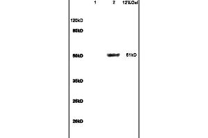 Lane 1: mouse brain lysates Lane 2: mouse liver lysates probed with Anti GCK/Glucokinase Polyclonal Antibody, Unconjugated (ABIN734558) at 1:200 in 4C. (GCK antibody  (AA 101-200))