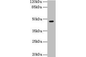 Western blot All lanes: NXF5 antibody at 4 μg/mL + HL60 whole cell lysate Secondary Goat polyclonal to rabbit IgG at 1/10000 dilution Predicted band size: 46, 43, 20, 36, 35 kDa Observed band size: 46 kDa (NXF5 antibody  (AA 1-200))