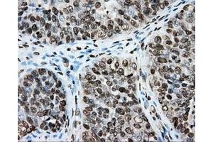Immunohistochemical staining of paraffin-embedded colon tissue using anti-CYP1A2 mouse monoclonal antibody. (CYP1A2 antibody)