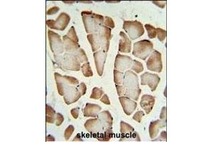 STX1A Antibody (N-term) (ABIN653770 and ABIN2843062) IHC analysis in formalin fixed and paraffin embedded skeletal muscle followed by peroxidase conjugation of the secondary antibody and DAB staining. (STX1A antibody  (N-Term))