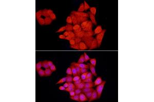 Immunofluorescence analysis of HeLa cells using GCH1 Rabbit pAb (ABIN7267525) at dilution of 1:100 (40x lens). (GCH1 antibody  (AA 1-250))