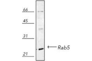 Western blot analysis of human HeLa (heat shocked) cell lysate, probed with Rab5 pAb. (RAB5 antibody)