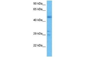 Western Blotting (WB) image for anti-Fibroblast Growth Factor 2 (Basic) (FGF2) (Middle Region) antibody (ABIN2777106)