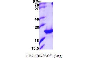 SDS-PAGE (SDS) image for Prostaglandin E Synthase 2 (PTGES2) (AA 1-186) protein (His tag) (ABIN667450) (PTGES2 Protein (AA 1-186) (His tag))