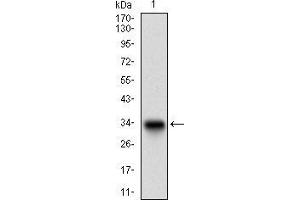 Western blot analysis using DCN mAb against human DCN recombinant protein. (Decorin antibody  (AA 263-324))