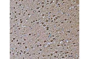 IHC analysis of VPS53 using anti-VPS53 antibody (ABIN7599731). (VPS53 antibody  (AA 11-699))