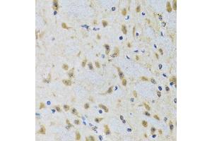 Immunohistochemistry of paraffin-embedded rat brain using ATG7 antibody.