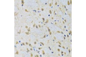 Immunohistochemistry of paraffin-embedded rat brain using ATG7 antibody. (ATG7 antibody  (AA 500-676))