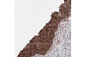 Immunohistochemical staining of human urinary bladder with SNX18 polyclonal antibody  shows strong cytoplasmic positivity in urothelial cells at 1:20-1:50 dilution.