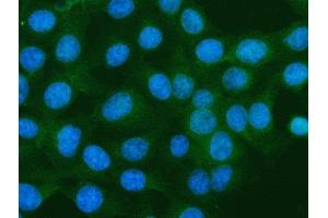 IF analysis of S100A10 using anti-S100A10 antibody (ABIN5692833). (S100A10 antibody  (AA 4-94))