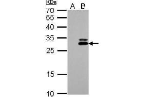 Kallikrein 7 antibody