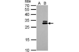 WB Image KLK7 antibody detects KLK7 protein by Western blot analysis. (Kallikrein 7 antibody)