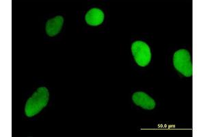 Immunofluorescence of purified MaxPab antibody to NOSIP on HeLa cell. (NOSIP antibody  (AA 1-301))
