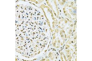 Immunohistochemistry (Paraffin-embedded Sections) (IHC (p)) image for anti-Heterogeneous Nuclear Ribonucleoprotein A2/B1 (HNRNPA2B1) (AA 1-180) antibody (ABIN3021593)