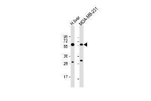 All lanes : Anti-UGT2B4 Antibody (N-term) at 1:8000 dilution Lane 1: human liver lysate Lane 2: MDA-MB-231 whole cell lysate Lysates/proteins at 20 μg per lane. (UGT2B4 antibody  (N-Term))