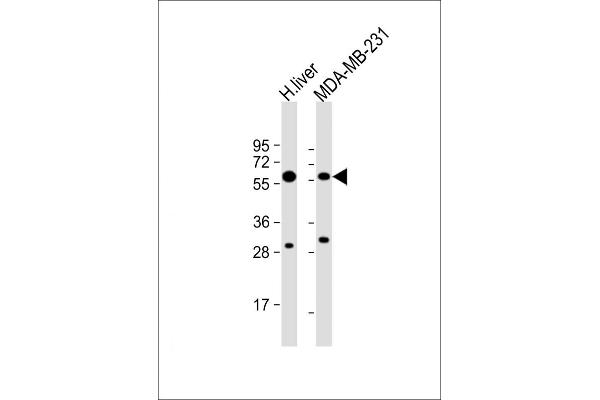 UGT2B4 抗体  (N-Term)