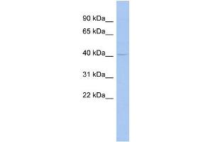 WB Suggested Anti-MSL3L1 Antibody Titration:  0. (MSL3 antibody  (Middle Region))